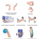 Golfers Elbow